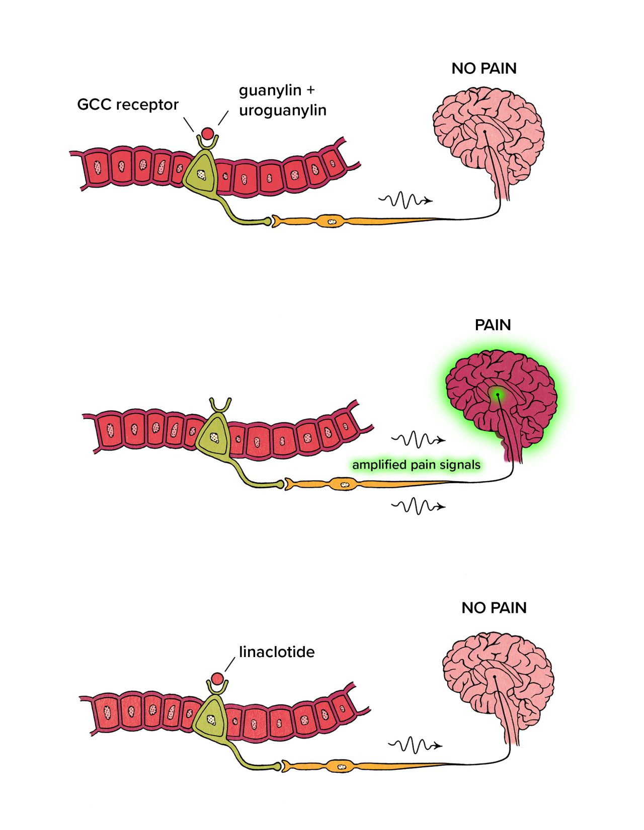 Illustration of linaclotide