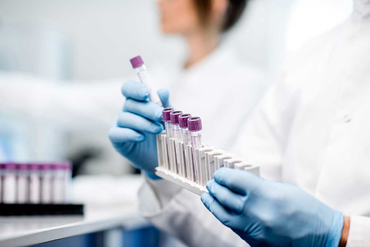 Scientist using multi-channel pipette to fill multiwell plate for analysis of antibodies by ELISA assay, Jenner Institute, Oxford University - stock photo