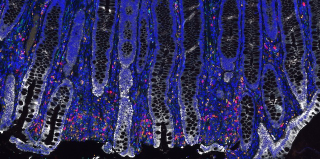 Artwork by Willie Baronet and Leah den Bok with researcher Rosie Frasso, PhD