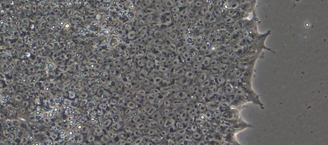 Human iPS Cell Colony at Day 7