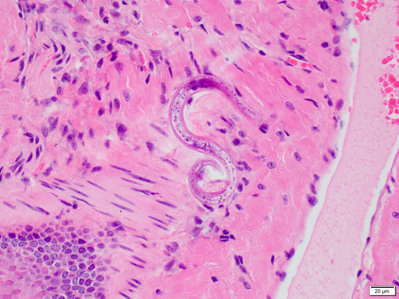 nematode infections