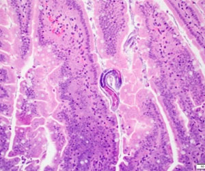Project 3 - Mechanism and therapeutic development for hyperinfection by Strongyloides stercoralis.