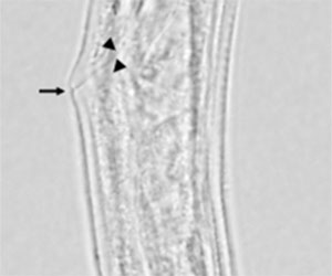 Project2 - Development of humanized mouse models for Onchocerca volvulus.