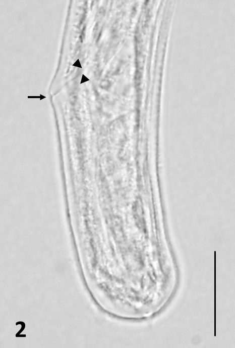 Project2 - Development of humanized mouse models for Onchocerca volvulus.