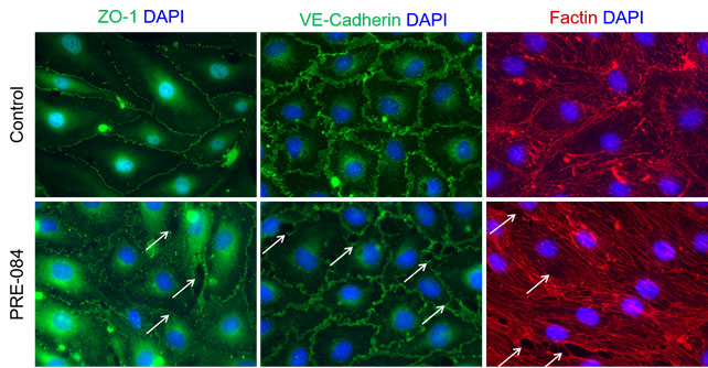 Modulation of the Blood-Brain Barrier by Sigma-1R Activation. 
