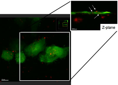 Breast cancer cells (green) take up osteoblast-derived exosomes (red, arrows)
