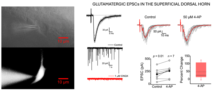 Regulation of Glutamatergic Pain Signaling in the Spinal Cord