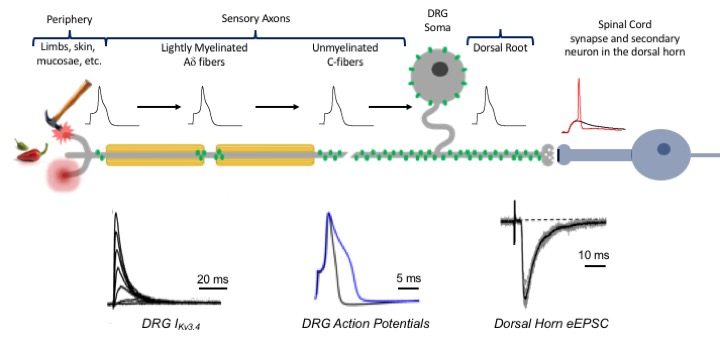 project1 - Dysregulation of the Kv3.4 potassium channel: implications in spinal cord injury-induced neuropathic pain