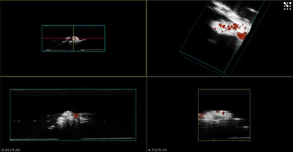 3D high frequency Doppler ultrasound showing anatomical detail (in gray) combined with blood flow (in red) of a fruit fly model used for cardiac research. High Image Frequency