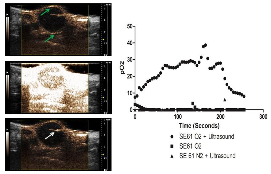 In vivo microbubble-assisted oxygen delivery to hypoxic tumors. Left: Ultrasound images of a tumor and oxygen probe (white arrow) showing microbubble arrival within the periphery of the tumor (top image, slight peripheral enhancement denoted with green arrows), the flash-destructive ultrasound pulse used to destroy the microbubbles (middle), followed by a slight decrease in peripheral enhancement immediately after microbubble destruction (bottom). Right: Intra-tumoral oxygen levels after injection of the oxygen-filled microbubble triggered with ultrasound, the oxygen-filled microbubble alone, and a nitrogen-filled microbubble triggered with ultrasound. in vivo microbubble