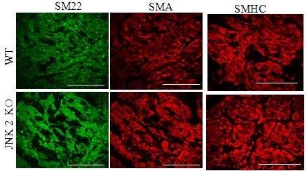 SM specific proteins in WT and JNK2 KO mice