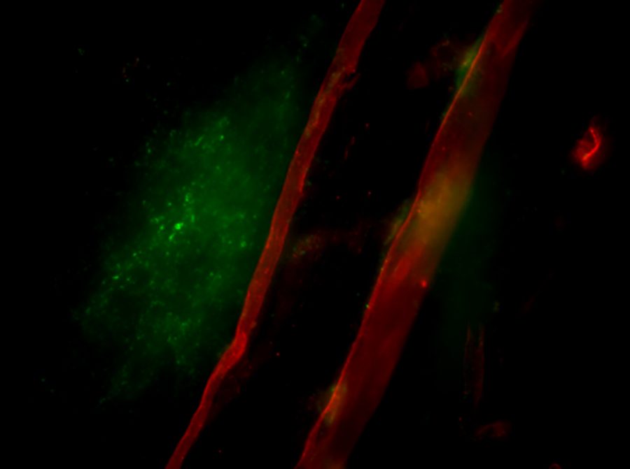 Extravasation of 70kDa FITC-labeled Dextran out of cerebral vasculature following rat sphenopalatine ganglion stimulation. BBB SPG stim