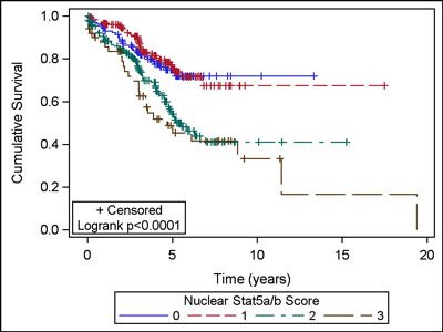 Elevated nuclear Stat5a/b expression predicts early lethal disease recurrence of prostate cancer after radical prostatectomy. Mirtti ALL BRS