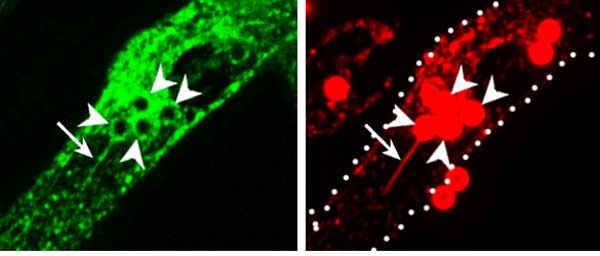 Phaagosomal Tubules