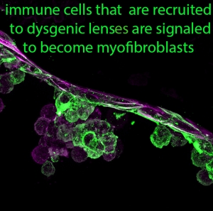 Myofibroblasts