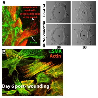 project1 - Day 6 post-wounding