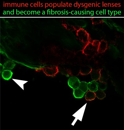 project 2 -  immune cells populate dysgenic lenses and become a fibrosis-causing cell type