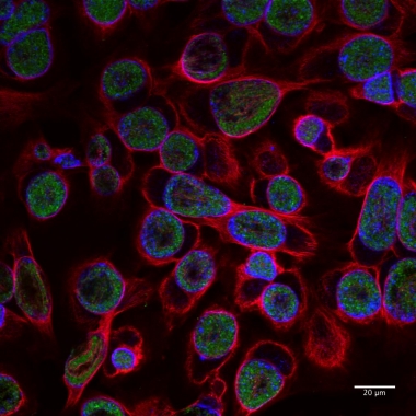 file - pathogenesis of Chlamydia trachomatis