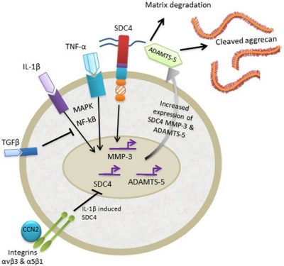file - Inflammation in the intervertebral disc.