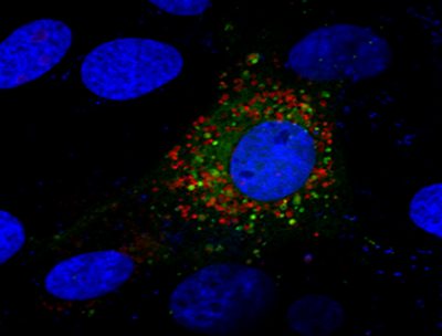 file - Regulation of Metabolic Systems in NP cells