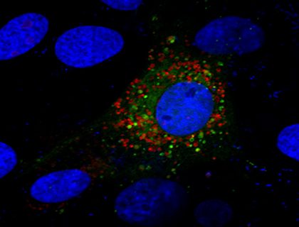 NP cells retrovirally transduced with tandem mCherry-EGFP-LC3B construct, showing yellow/green autophagosomes and red autolysosomes. file - Regulation of Metabolic Systems in NP cells