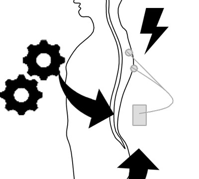 Image of outline of body with stimulation devices attached
