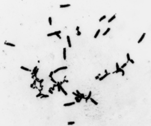 Chromosomes