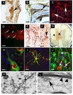 figure1 - Effects of Viral Infections and peripheral immune system/CNS crosstalk on the Etiology and Progression of Parkinson’s Disease
