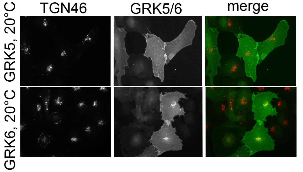 project3 - Mechanisms of localization and trafficking of GRKs