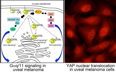 project2 - Signaling by mutant G alpha q/11 subunits in uveal melanoma